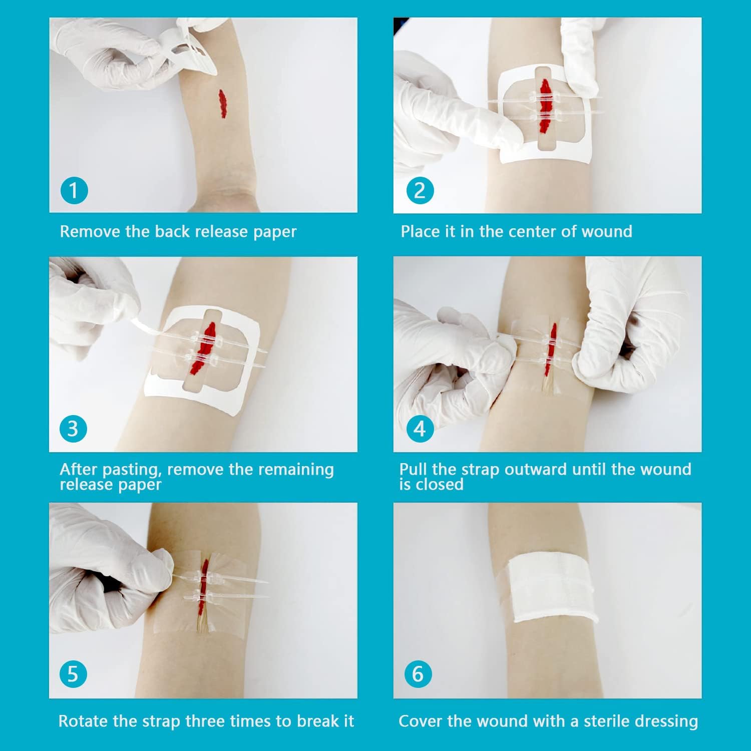 Emergency Wound Closure Strips Zip Stitch Sutures Kit, 2 Pcs Zipstitch Butterfly Bandages Laceration Closure Kit, Quick Clot Wound Closure Device for Wound Care - Image 7