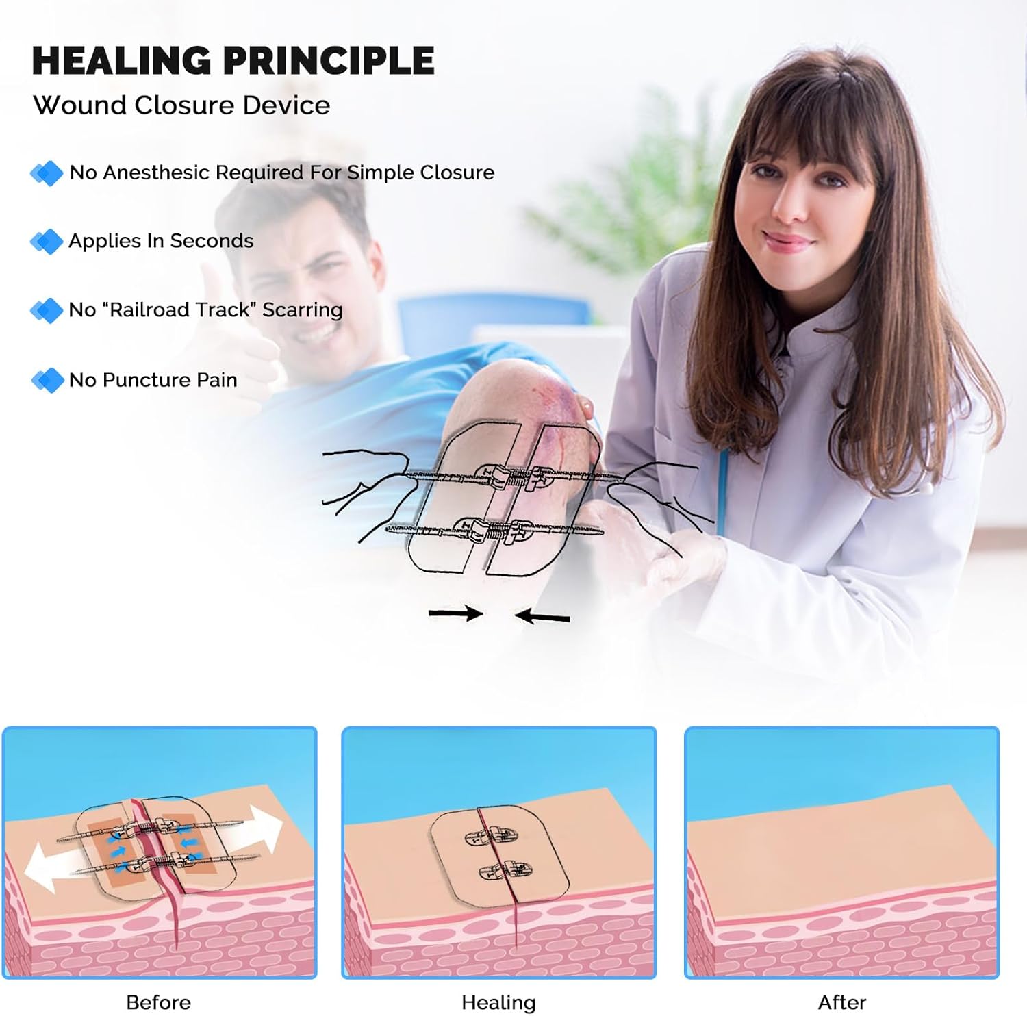 Emergency Wound Closure Strips Zip Stitch Sutures Kit, 2 Pcs Zipstitch Butterfly Bandages Laceration Closure Kit, Quick Clot Wound Closure Device for Wound Care - Image 4